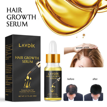 Oil Anti Preventing Hair Lose Liquid